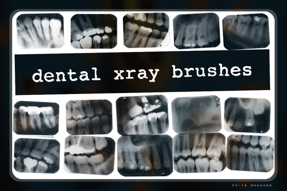 Dental X-ray Brushes